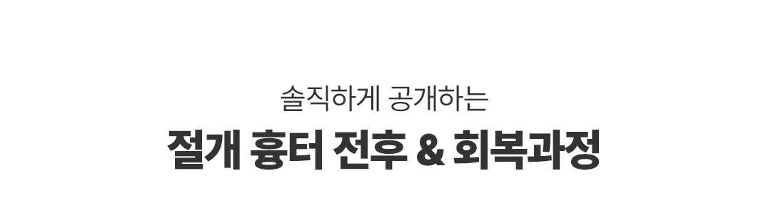 절개 흉터 타이틀