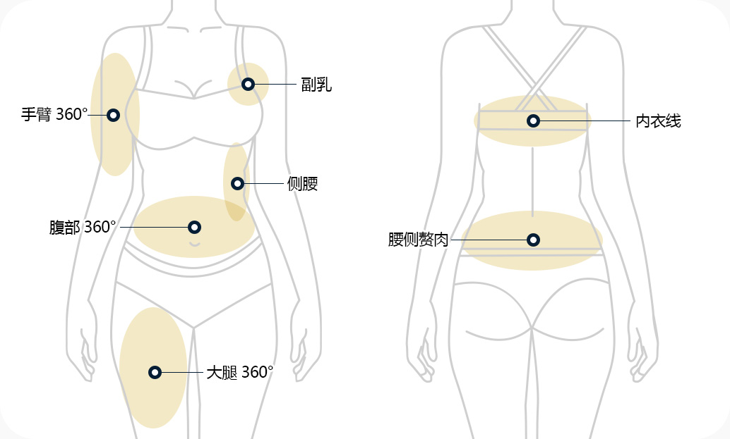지방흡입 부위 팔 360도 부유방 옆구리 복부 360도 허벅지 360도 브라라인 러브핸들