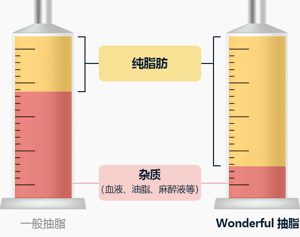 원더풀 바디 지방흡입 불순물 혈액 오일 마취용액 등 보다 높은 비율의 순수지방 추출