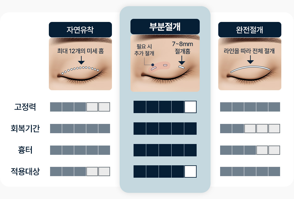 원더풀 부분절개 자연유착 완전절개 빠른회복력 흉터최소화 강한고정력 적용 가능한 대상 다양함