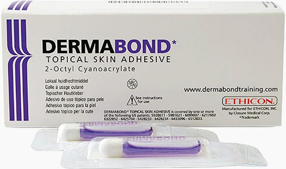 더마본드 흉터관리 실밥제거없음