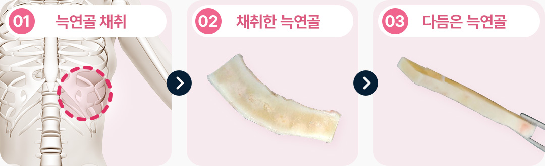 防止翘曲(Warping)的技术