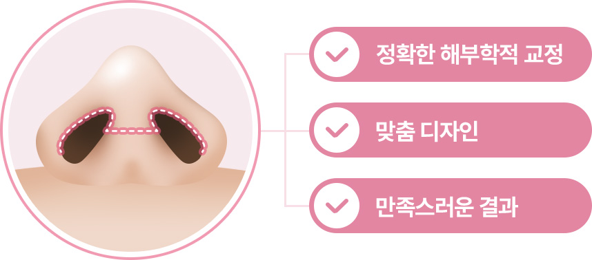 개방형 코수술 정확한 해부학적 교정 맞춤디자인 만족스러운 결과