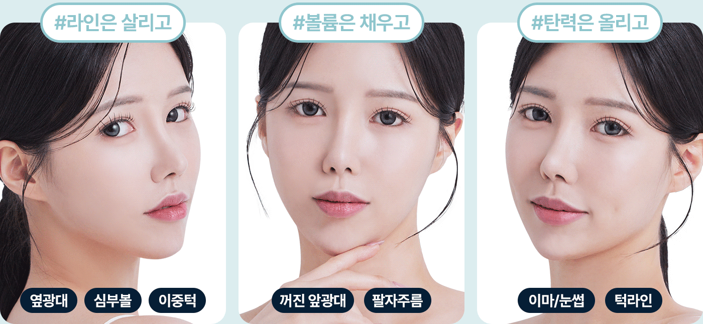 울쎄라 라인 맞춤 부위 옆광대 심부볼 이중턱 볼륨 맞춤 부위 앞광대 팔자주름 탄력 맞춤부위 이마 눈썹 턱라인 