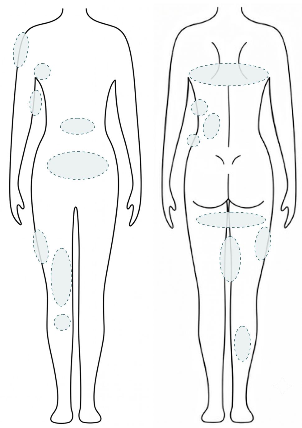 WonderFit 溶脂针身体施打部位说明